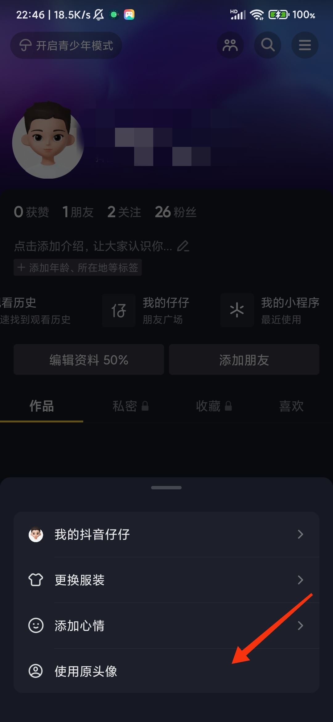 抖音仔仔怎么關(guān)閉？