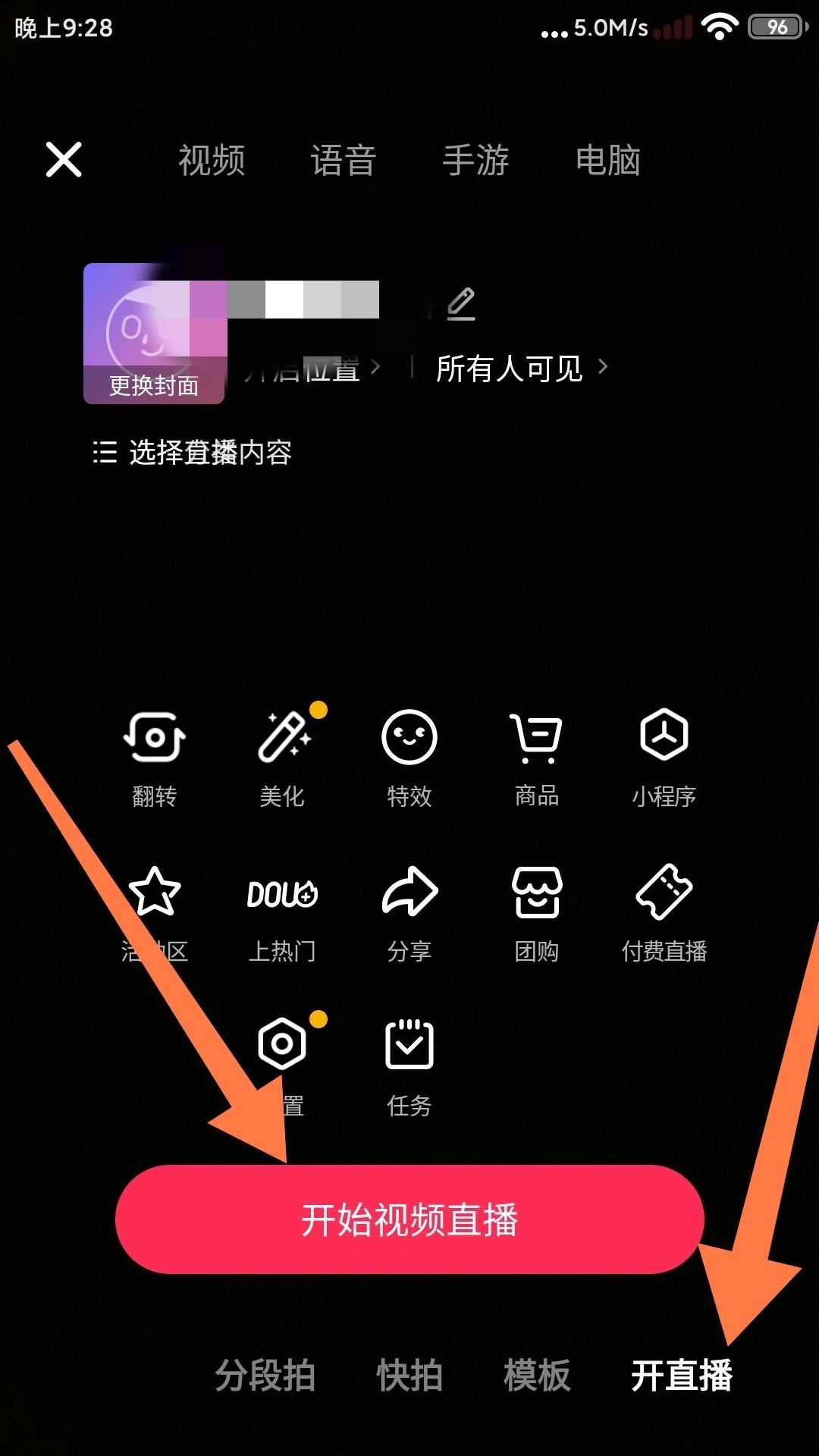 抖音直播唱歌伴唱怎么弄的？