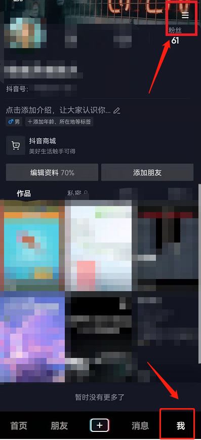 怎么把抖音和相冊(cè)的同步關(guān)掉？