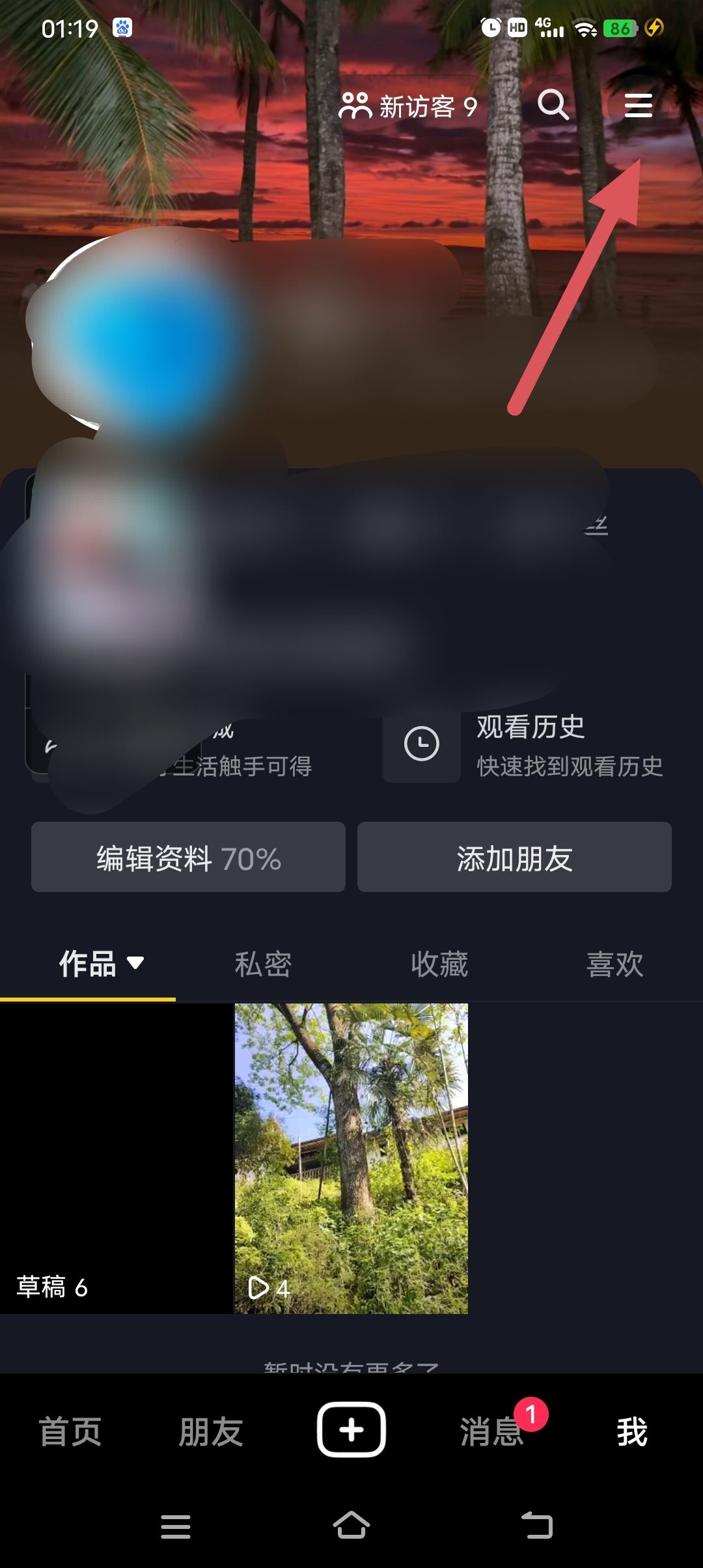 抖音自己發(fā)的作品怎樣無水印保存？
