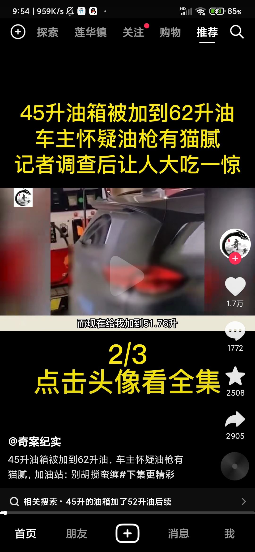 抖音頭像上快進按鈕怎么設(shè)置？
