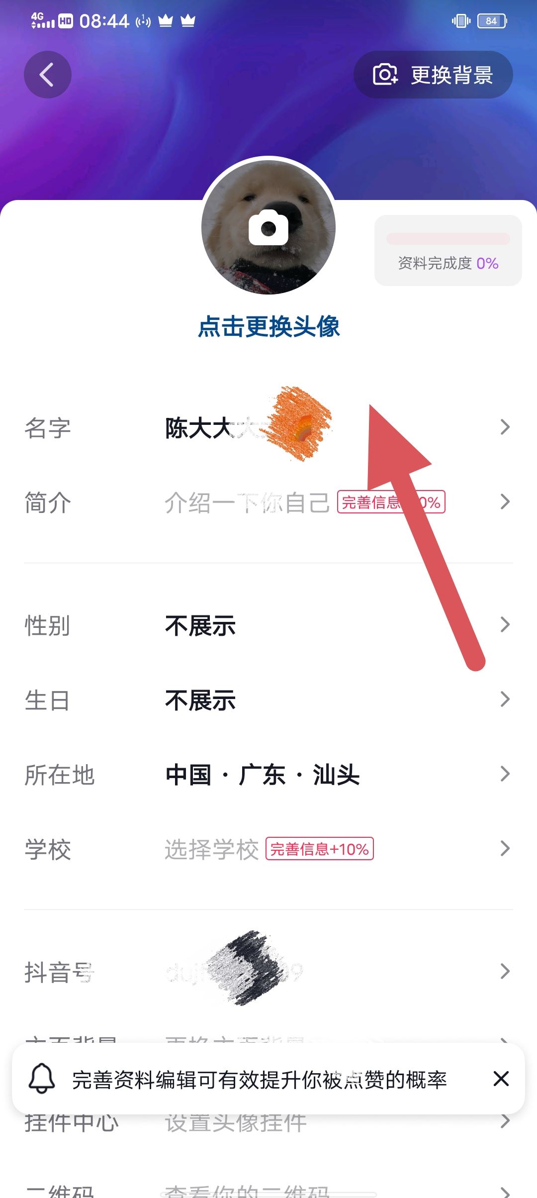 抖音30天只能修改4次名字怎么解除？