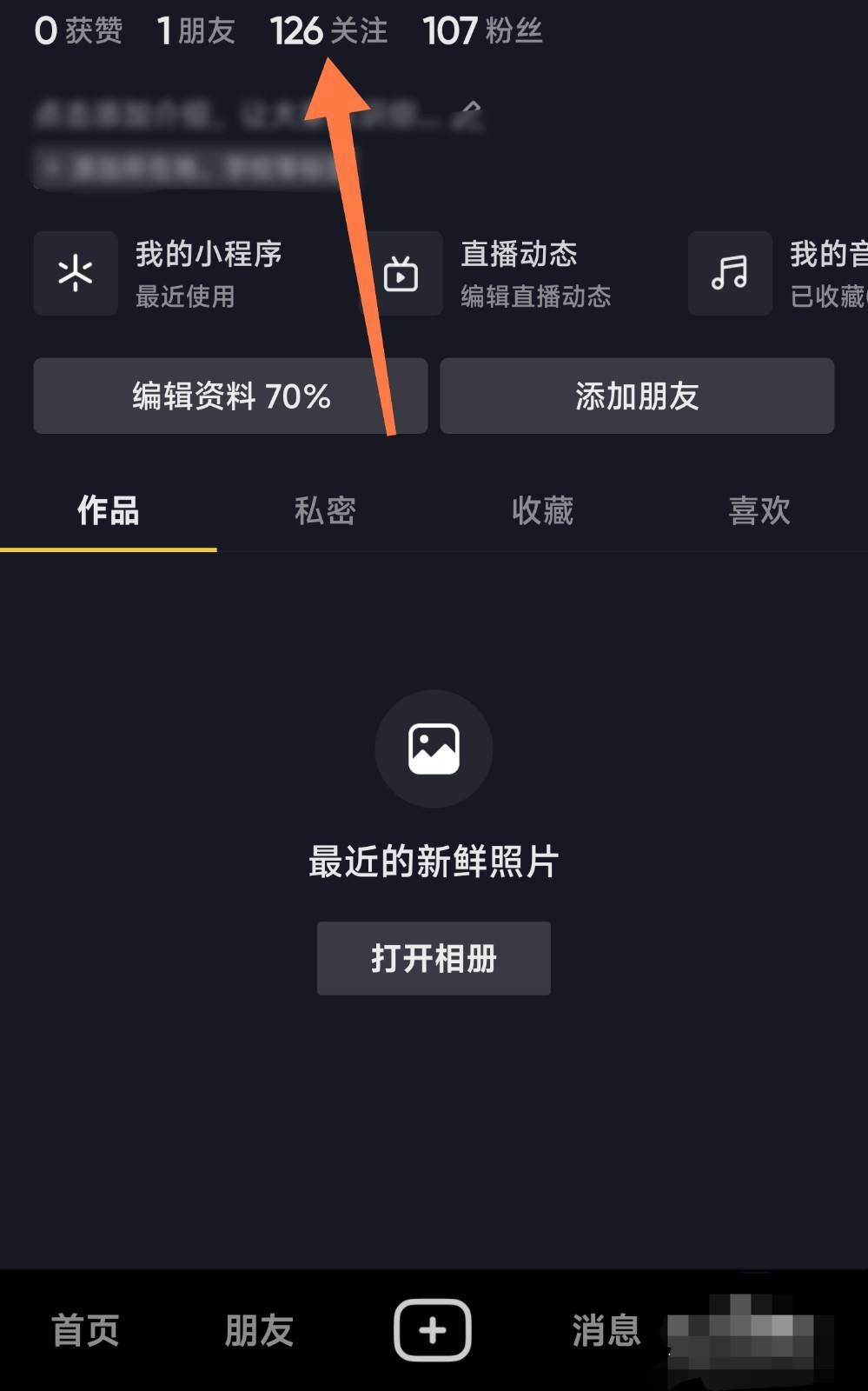 抖音特別關(guān)心怎么設(shè)置？