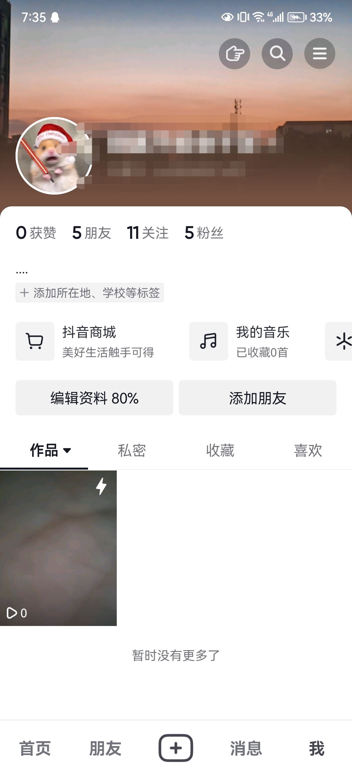 抖音發(fā)的日常怎么轉(zhuǎn)成永久？